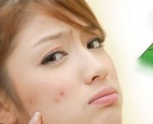 青春痘案例