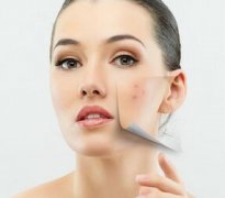 重庆祛痘医院哪家好